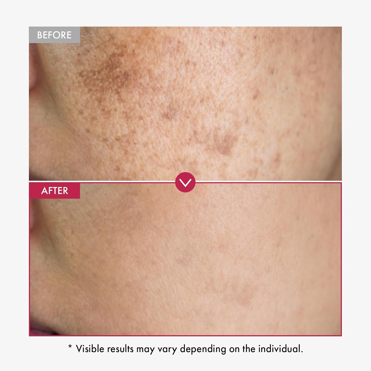 Sérum visage blanchissant pour - Alpha Arbutin Serum avis et prix