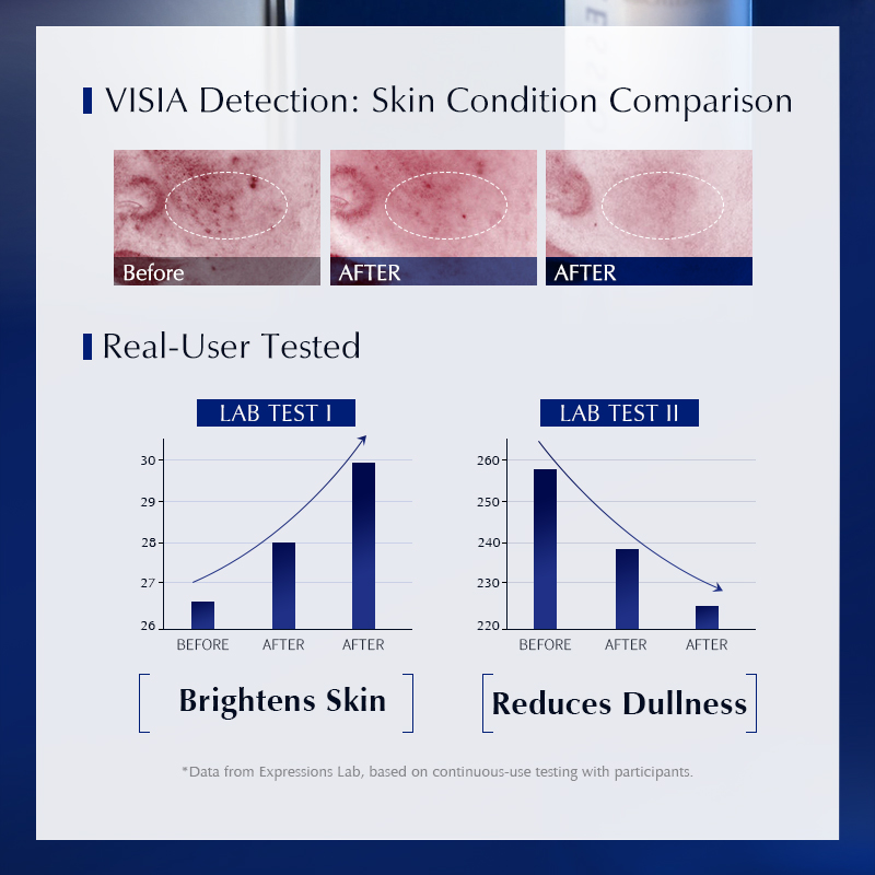 Sérum pour le visage à la niac - Alpha Arbutin Serum avis et prix